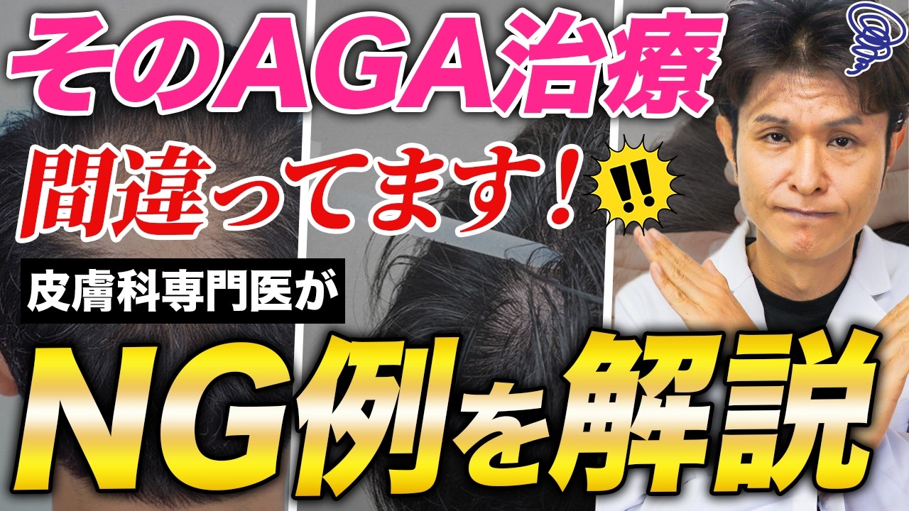 AGA治療薬おすすめランキング｜薄毛が気になり始めたら必見【皮膚科医解説】