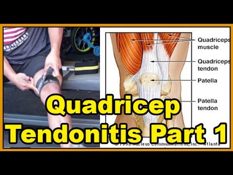 pain tendonitis knee quadricep