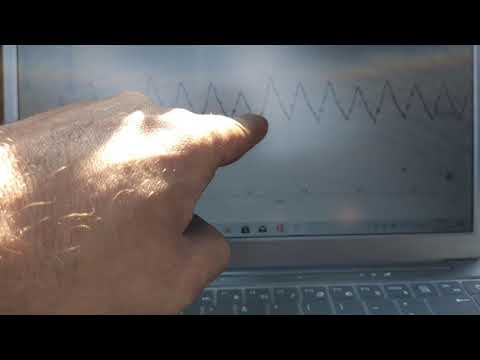 Audi TT case study Part 1 (P0304 cylinder 4 misfire) injector shutdown