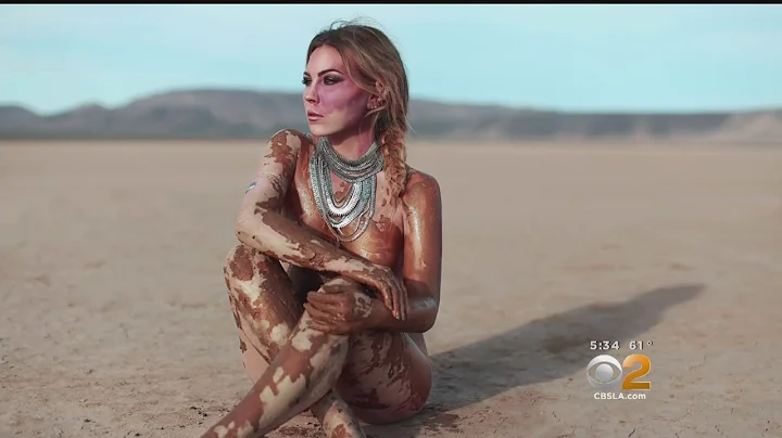 Actress Bullied Over Birthmark Turns Her Flaw Into...