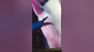 Ovarian Cystectomy simulation model training