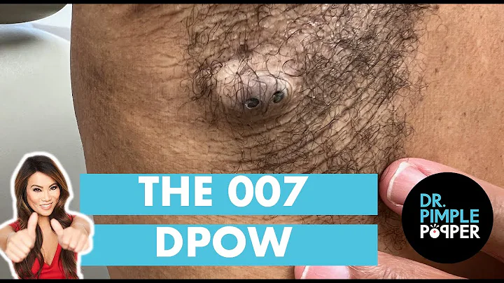 The 007 DPOW