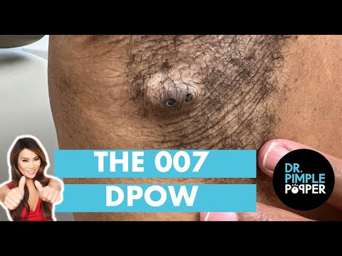 The 007 DPOW
