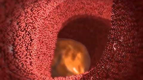 Absorption in the Small Intestine: Learn@Visible Body