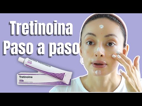 Vídeo: La crema Tetrix és de ventall?