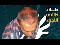 طلاء طالبي اللجوء