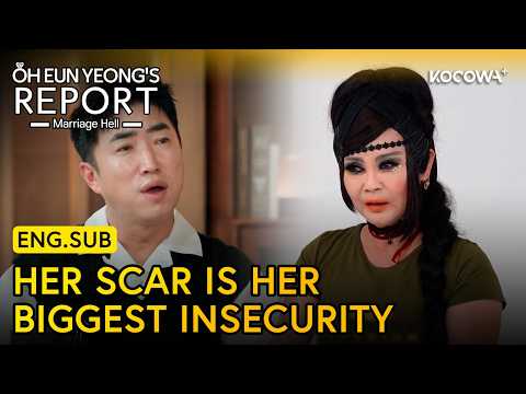 She Has a Scar on Her Face, but Many More in Her Heart 😔 | Oh Eun Yeong's Report EP183 | KOCOWA+