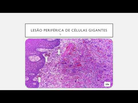 Vídeo: Displasia Do Tecido Conjuntivo Em Crianças