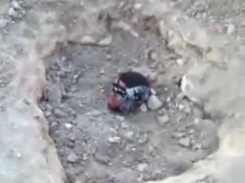 اثار تعذيب معتقل في سجون النصيرية