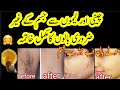 permanent hair removal at home l best hair removal cream |kitchen & home tips and tricks