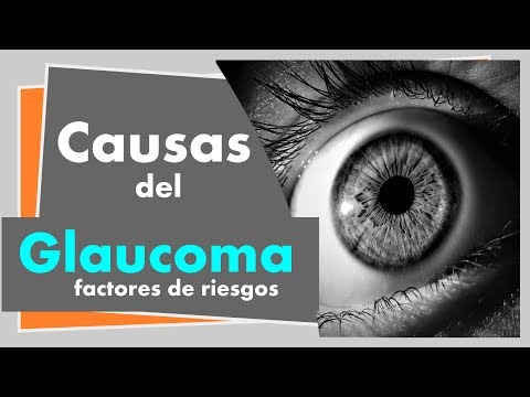 estas son las causas del glaucoma (factores de riesgo de glaucoma)