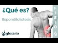 ESPONDILOLISTESIS | Qué es, qué estructuras afecta, síntomas, signos clínicos, causas y tratamiento