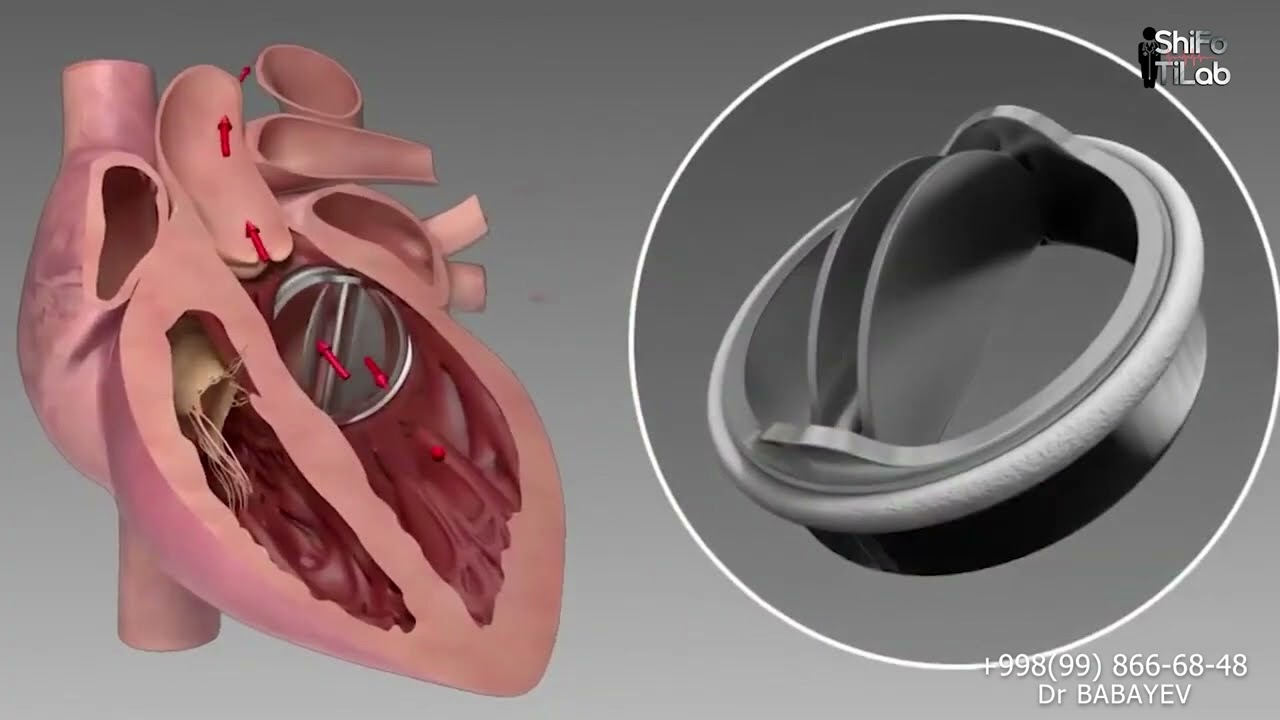 Malakali shifokor bolalar kardio-xirrurgi doktor Afzal Babayev!!!