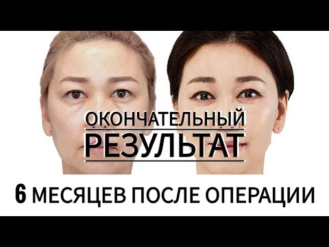 Video: Dzhanabaeva proved the absence of plastic surgery