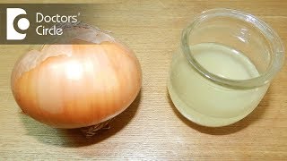 Can onion juice be helpful in regrowth after patchy hair loss? - Dr. Farida Khan