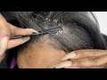 Dandruff Scratching Collection Pt. 2 | Let’s Go!