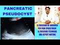 Pancreatic pseudocyst ultrasound | Pancreas ultrasound | pancreas ultrasound scanning technique 