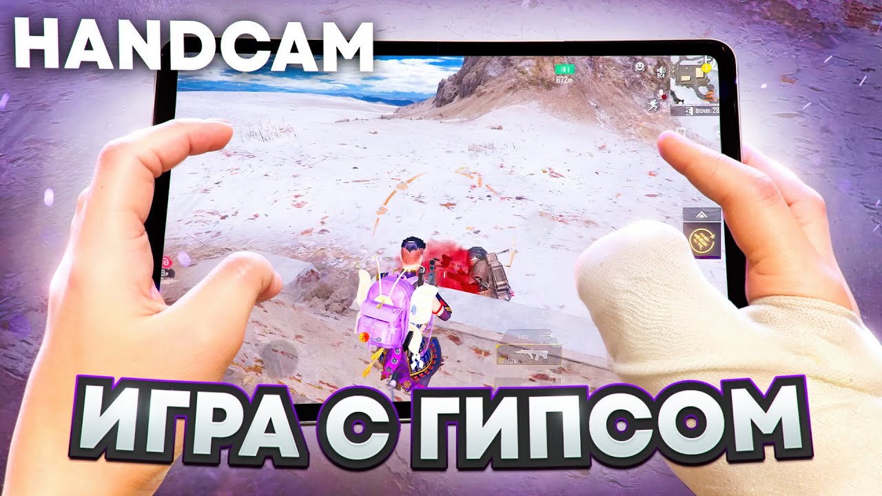 КАК Я ИГРАЮ С ГИПСОМ НА ПАЛЬЦЕ? 🔥 | METRO ROYALE | PUBG MOBILE