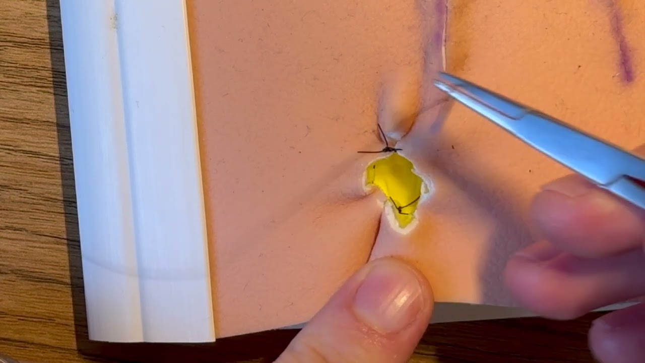 'Purse string' suture - reduce wound size and speed up healing  4K