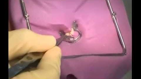 Paper points in Endodontics