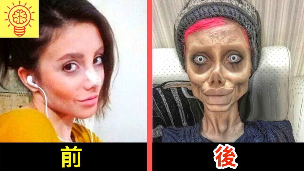 慘！ 31歲高顏值女星整容失敗毀容，鼻頭髮黑壞死，高溜的演繹生涯或就此結束，還要面臨200萬違約賠償！