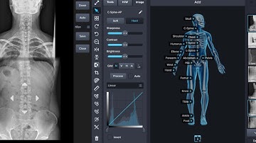 Full-Spine X-ray Stitching Software