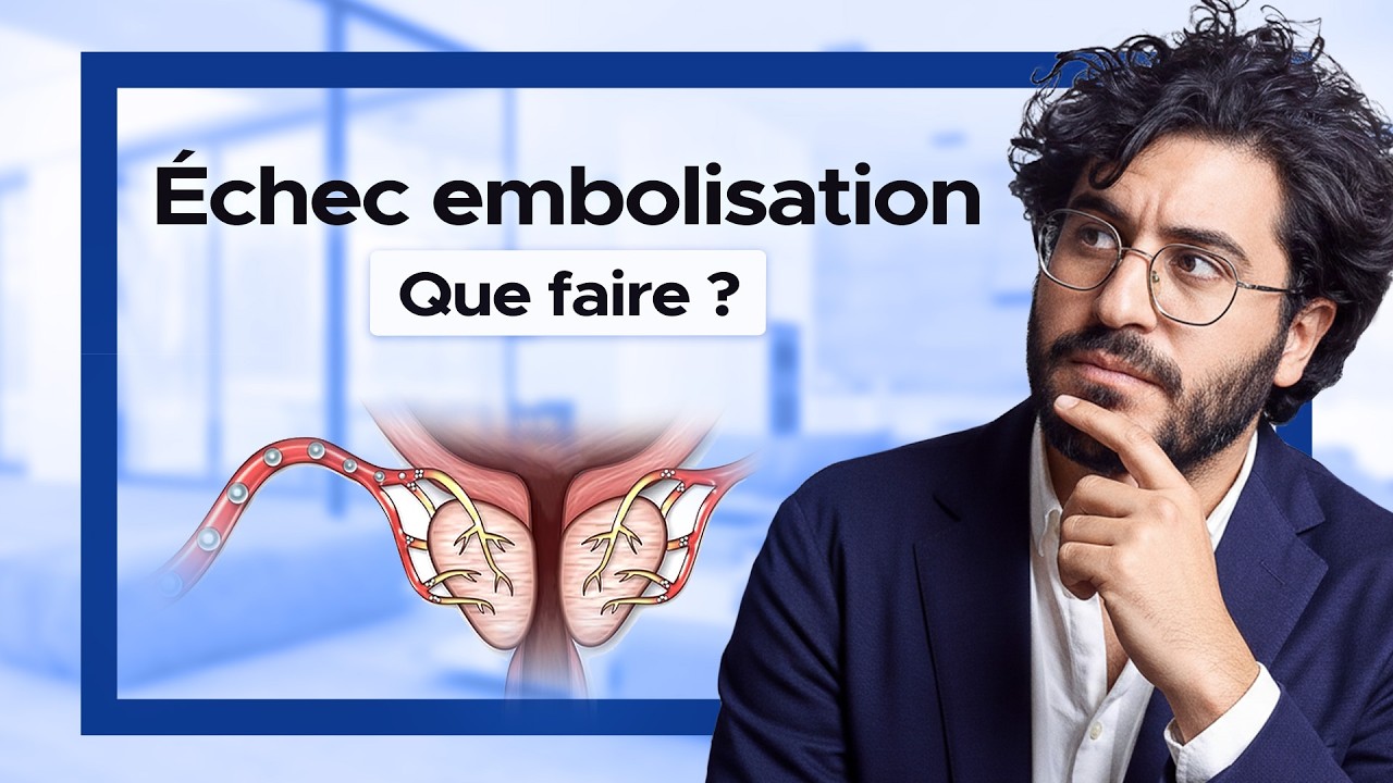 Varicocèle : pourquoi l’embolisation ne fonctionne pas toujours ? Réponse du Dr Davy Benarroche