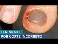 FERIMENTO POR CORTE INCORRETO