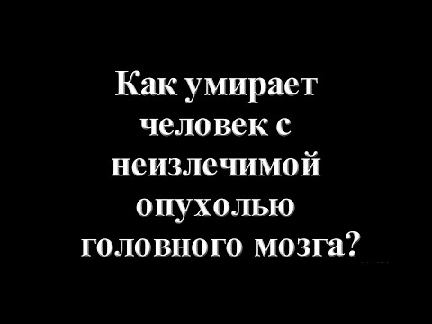 Видео: Являются ли опухоли астроцитомы раковыми?