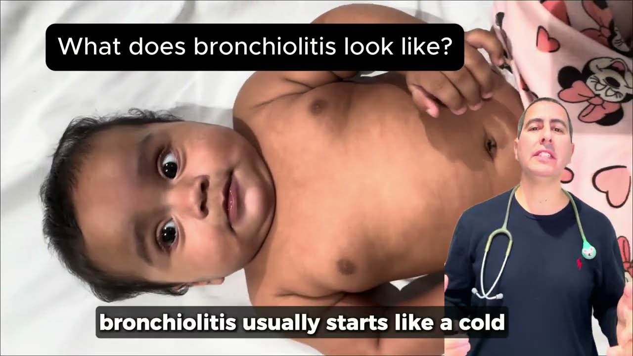 Bronchiolitis in Babies: Signs Every Parent Should Know