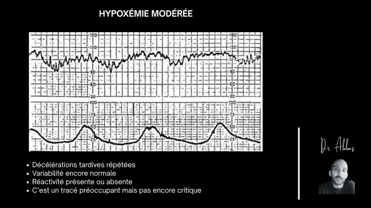 Comment interpréter un ercf : Épisode 10 - Le manque d’oxygène