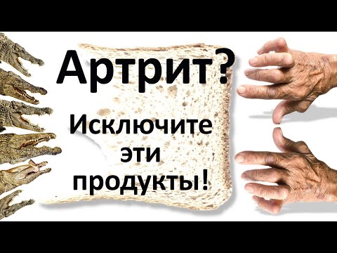 Артрит и артроз: какие продукты исключить, чтобы выздороветь