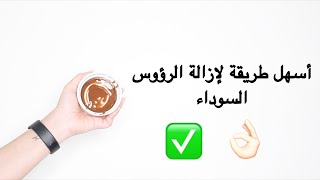 DIY | أسهل طريقة لإزالة الرؤوس السوداء