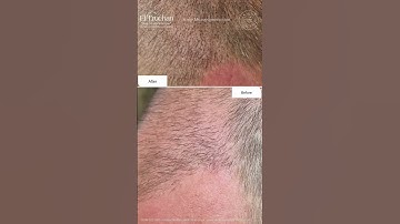 How long does it take for SMP pigment to settle?