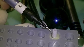 Custom Healing Abutments made with printed template