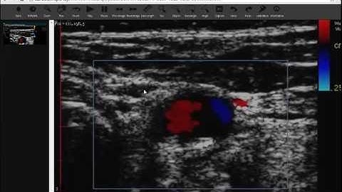 JavaScript  DICOM Viewer with Measurement Tools
