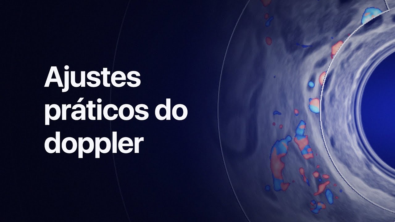 Como Ajustar corretamente Doppler no Ultrassom Transvaginal | Escola de Ultrassom