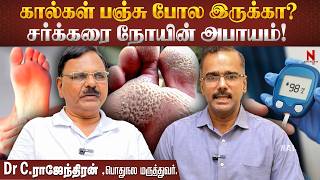 கால்கள் பஞ்சு போல இருக்கா? உடனே போய் Docter-அ பாருங்க!  Diabetes | Nakkheeran 360