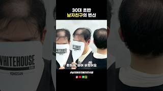 30대 초반 남자친구의 변신