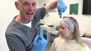 How to Treat Crow's Feet with Botulinum Toxin | Cosmetic Courses, Mr Adrian Richards