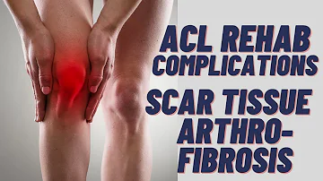 ACL Surgery - SCAR TISSUE / Arthrofibrosis