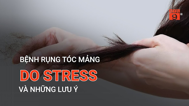 Tóc rụng từng mảng là bệnh gì