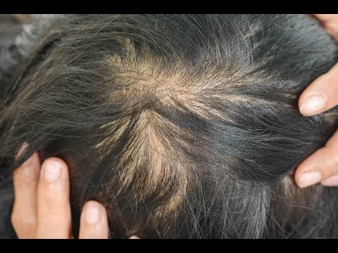 Video: 3 Cara Menata Rambut yang Menipis