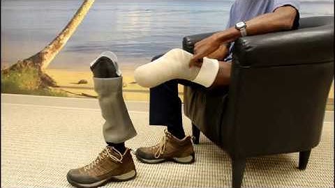 Transtibial Suction Suspension