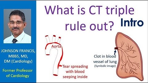 What is CT triple rule out? Intro