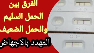 كيف تميزين بين حمل سليم وحمل ضعيف مهدد بالاجهاض