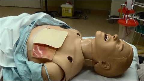 Manage an open pneumothorax