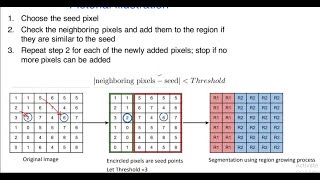 Edge detection on similarity bases. region based,atershed algoriths in detail Wealth