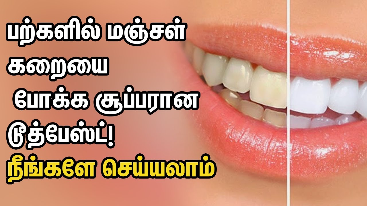 Gum Disease And Whiten Teeth With Natural Homemade Toothpaste YouTube