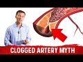 The Clogged Artery Myth